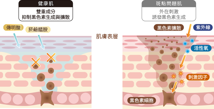 從源頭預防斑點