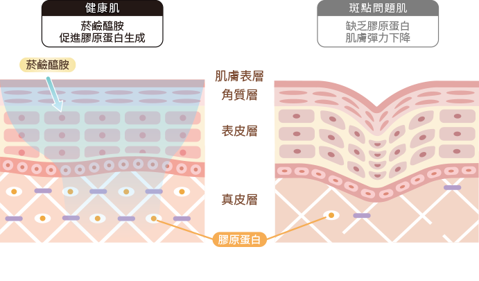 改善皺紋